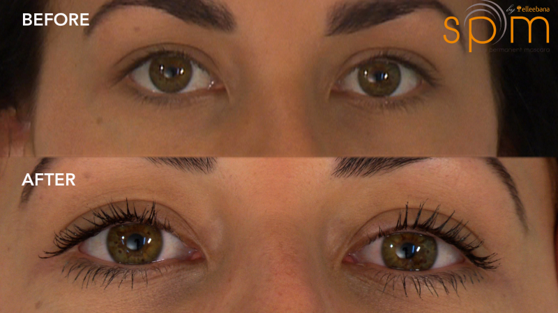spmbeforeandafter-for-web-133 spmbeforeandafter-for-web-133